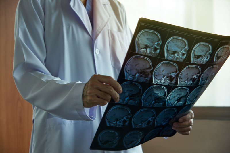 A doctor reviews an MRI scan