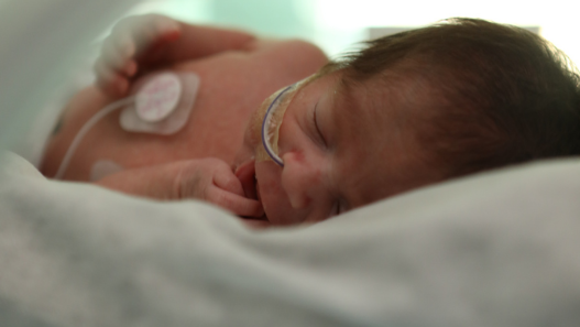 Valley Children’s Hospital First in U.S. to Use Advanced Genetic Testing to Save Babies’ Hearing