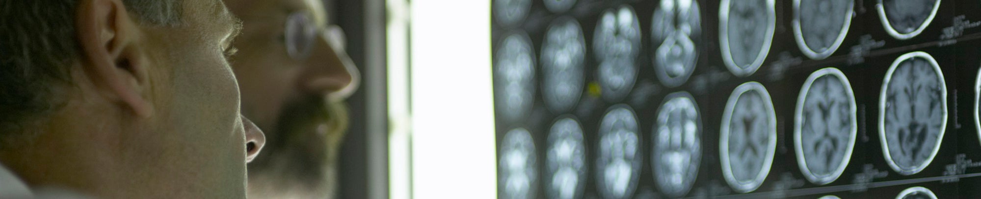 Contact Neurology